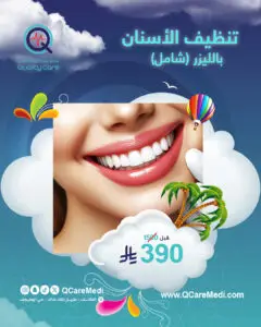 تبييض الأسنان بالليزر شامل