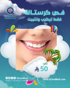 تركيب فص كرستاله