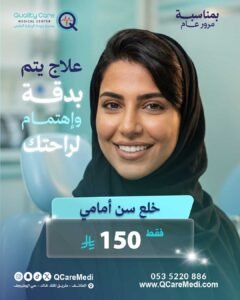 خلع سن أمامي