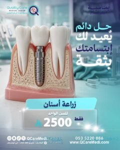 زراعة أسنان للسن الواحد